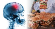 40% de los mexicanos está en riesgo de infarto cerebral por colesterol alto