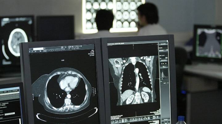 Los radiólogos de Vigo van a la huelga para pedir más médicos de guardia: «Ahora es un infierno»