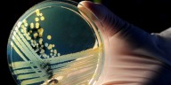 Qué es Maldi-Bot, el sistema argentino de inteligencia artificial que ayuda a detectar bacterias