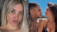 Mauro Icardi se borró los tatuajes de Wanda Nara y la China Suárez lo mostró en redes