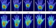 La inteligencia artificial identifica el sexo en radiografías de mano con más del 95% de precisión
