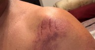 Man 'attacked by a leopard' walking in English countryside and beast left claw marks