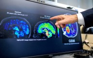 Científicos latinos en EEUU hallan biomarcador que podría detectar temprano el Alzheimer
