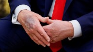 Trump, who questioned his opponents' health, rebuffs rumors about his own