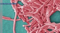Officials urge residents to get tested amid Marshall County Legionnaires’ outbreak