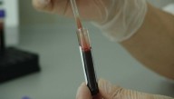 Descubren cómo el VIH facilita la tuberculosis y cómo frenarlo