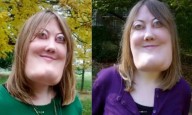 El caso de Victoria Wright: notó que su rostro comenzó a cambiar y fue diagnosticada con querubismo