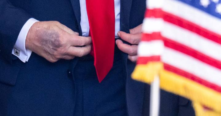 Trump's 'deteriorating' health as experts say he could have had 'mini strokes'