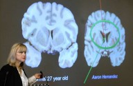 Here's what to know about CTE, the brain disease the NYC shooter blamed for his mental health issues