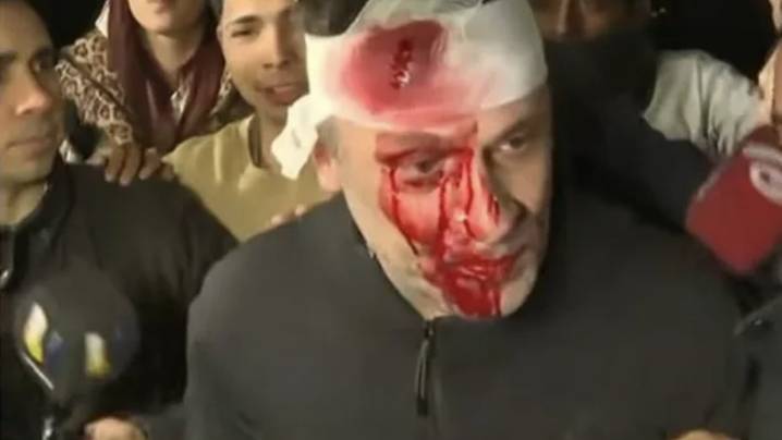 Agredieron a periodista de América TV en el acto de Javier Milei en Moreno