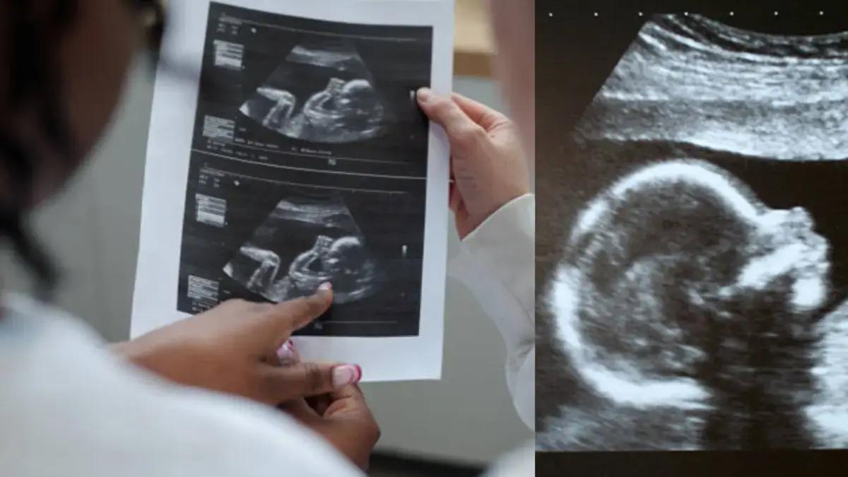 Escándalo por empresa japonesa que vendía ecografías robadas y eran usadas para engañar a hombres con falsa paternidad: 'Fechas y nombres editables'