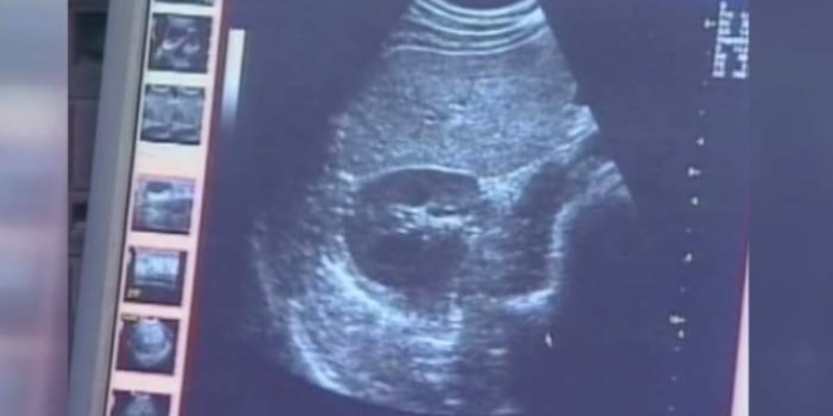Lawmakers voice concern on issue of paid parental leave for stillbirths in SC