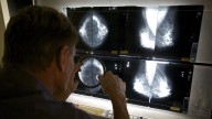 New breast cancer screening trial may answer key AI question