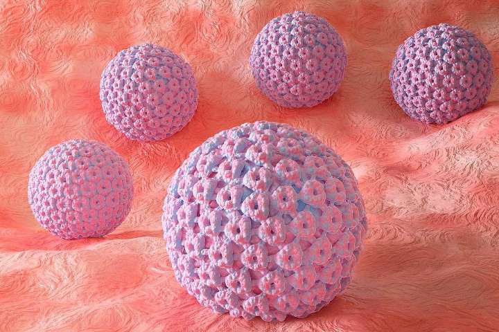 Deescalated Radiotherapy Tolerated After Surgery for HPV