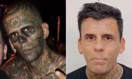 'Hombre más tatuado del mundo' logró "limpiar" su piel gracias a máquina millonaria