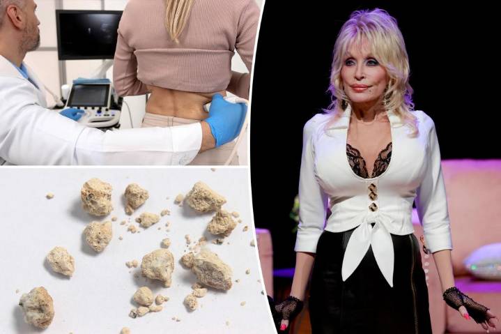 Dolly Parton misses event due to kidney stone