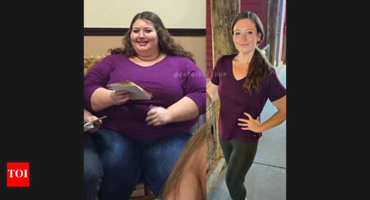 Weight loss story: Woman with rare disease, Calciphylaxis, sheds over 135 kilos; here’s her inspirational journey