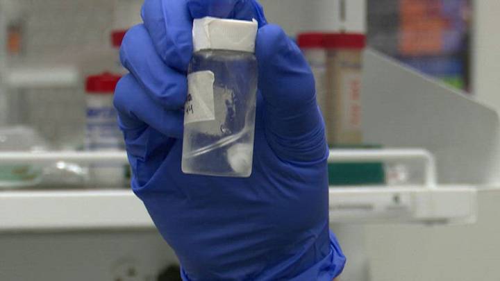 New gel could help chemo patients keep their hair