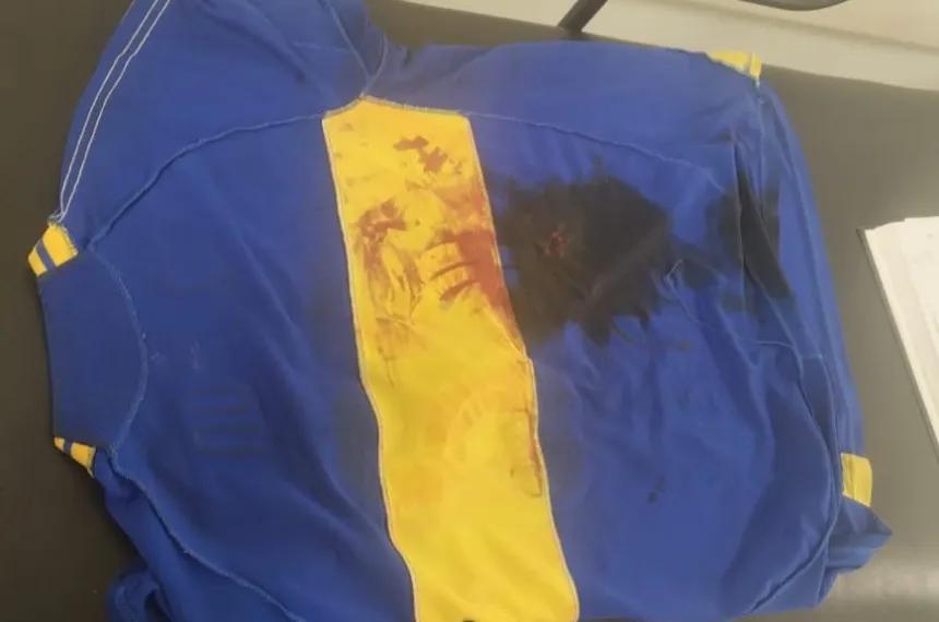 Un joven fue apuñalado con un fragmento de cuchillo en el barrio Matadero