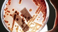 Aumentan en Estados Unidos las infecciones por bacterias resistentes a los antibióticos