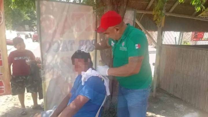 Motociclista lesionado al derrapar en Ixtlapalaco