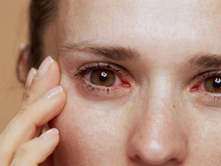 Tipos de alergias oculares