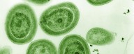 Ocean Warming Threatens Microbe That Makes Nearly a Third of Earth's Oxygen