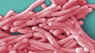 Legionnaires’ cases in Iowa prompt CDC support, no spread expected