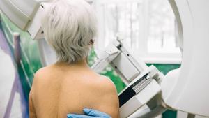 Mammograms May Still Save Lives for Women in Their 80s, Study Finds