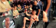 Debutó en la UFC por una baja de último momento, terminó en silla de ruedas y lo apodaron el “peor peleador”: así quedó su pierna