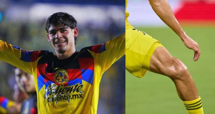 Dagoberto Espinoza, lateral del América, fuera de la temporada por grave lesión