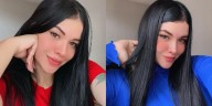 Venezolana en Perú denunció que intentaron degollarla frente a su domicilio