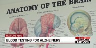 Earlier, more accurate detection of Alzheimer's disease available in the Heartland