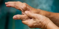 Signos ocultos de artritis reumatoide encontrados en la sangre mucho antes del diagnóstico