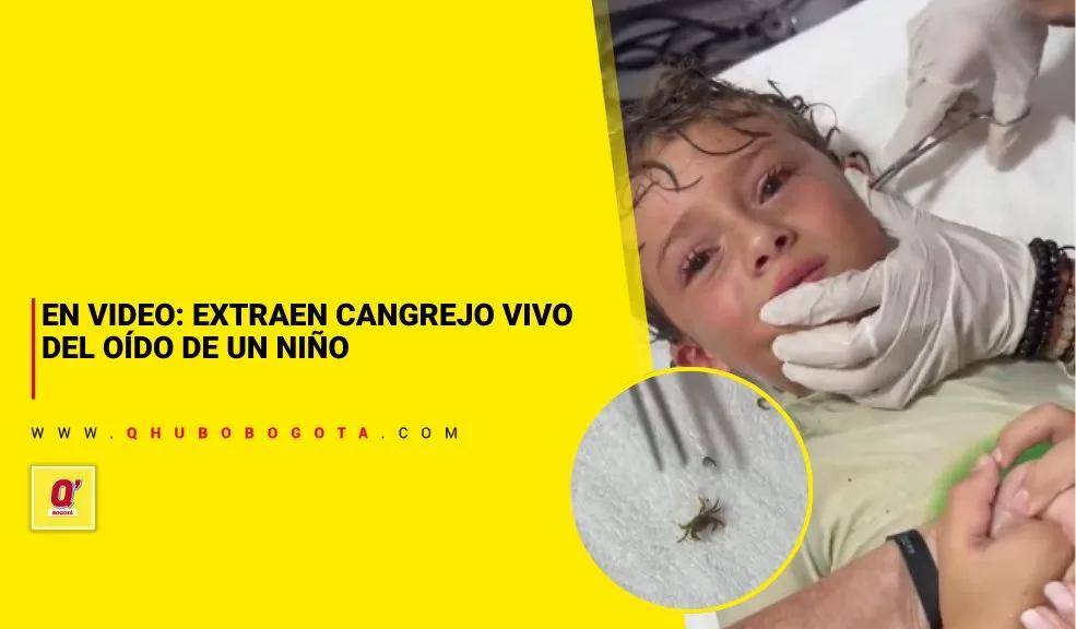 En video: extraen cangrejo vivo del oído de un niño