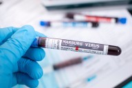 The Marburg Virus Outbreak in Rwanda. It Could Have Been Much Worse