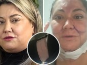 Denisse Campos rompe el silencio y asegura que sus intervenciones estéticas son para ingresar a un reality: "Yo no quiero decaer físicamente"