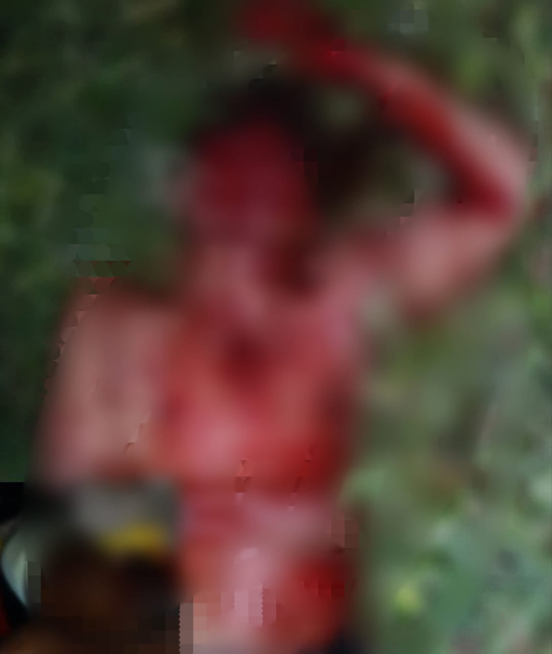 Parranda termina en un mar de sangre en Temax; machetazos dejan tres personas lesionadas