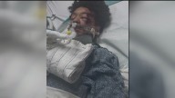 Family of metro Atlanta boy hurt in deadly Alabama ATV crash questions safety at park