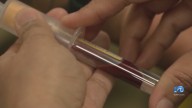 VDH launches Phase 1 of statewide sickle cell registry as Hampton Roads leads Va. in cases