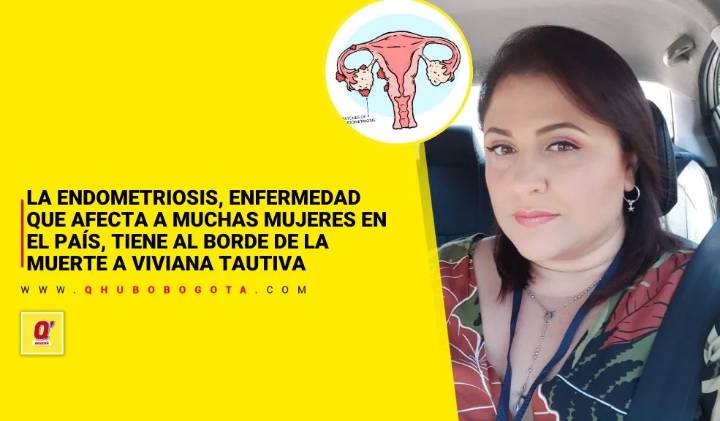 La endometriosis, enfermedad que afecta a muchas mujeres en el país, tiene al borde de la muerte a Viviana Tautiva