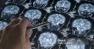 Las personas con un alto nivel educativo podrían ser diagnosticadas con alzhéimer más tarde que el resto
