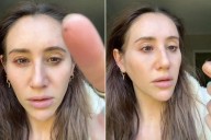Woman Wakes Up to Tick in Her Eye After Spending Hours Doing Yard Work (Exclusive)
