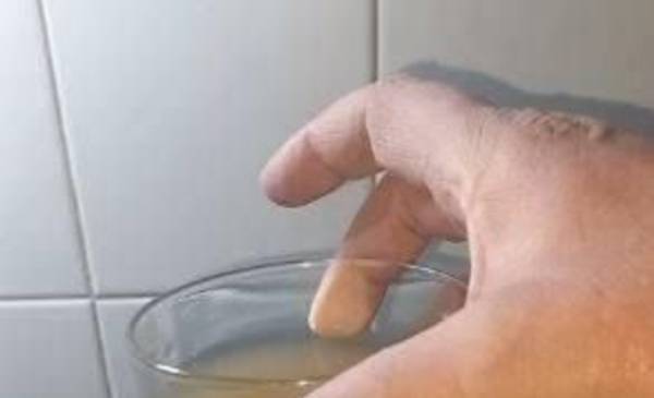 Agua marrón y canillas secas, dos problemas que provocan angustia en distintos barrios de La Plata