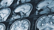 N.B. delays report on mystery brain illness, sends all data for federal review