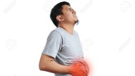 El síndrome de colon irritable