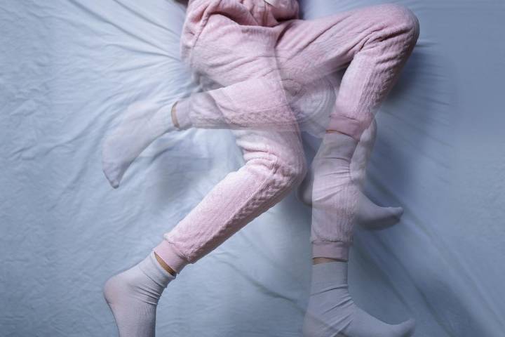 Periodic Limb Movements Occur Frequently in Persons With Epilepsy