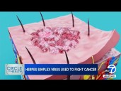 Scientists turn common herpes virus into cancer
