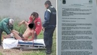 Revelan el frondoso prontuario del joven atacado por perros en Yerba Buena