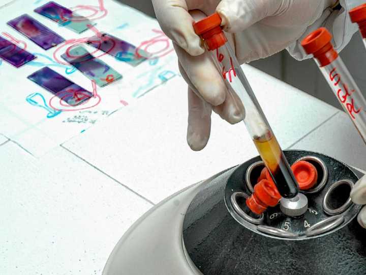 EPS controladas por el gobierno mueven miles de pacientes VIH a clínica con atención deficiente